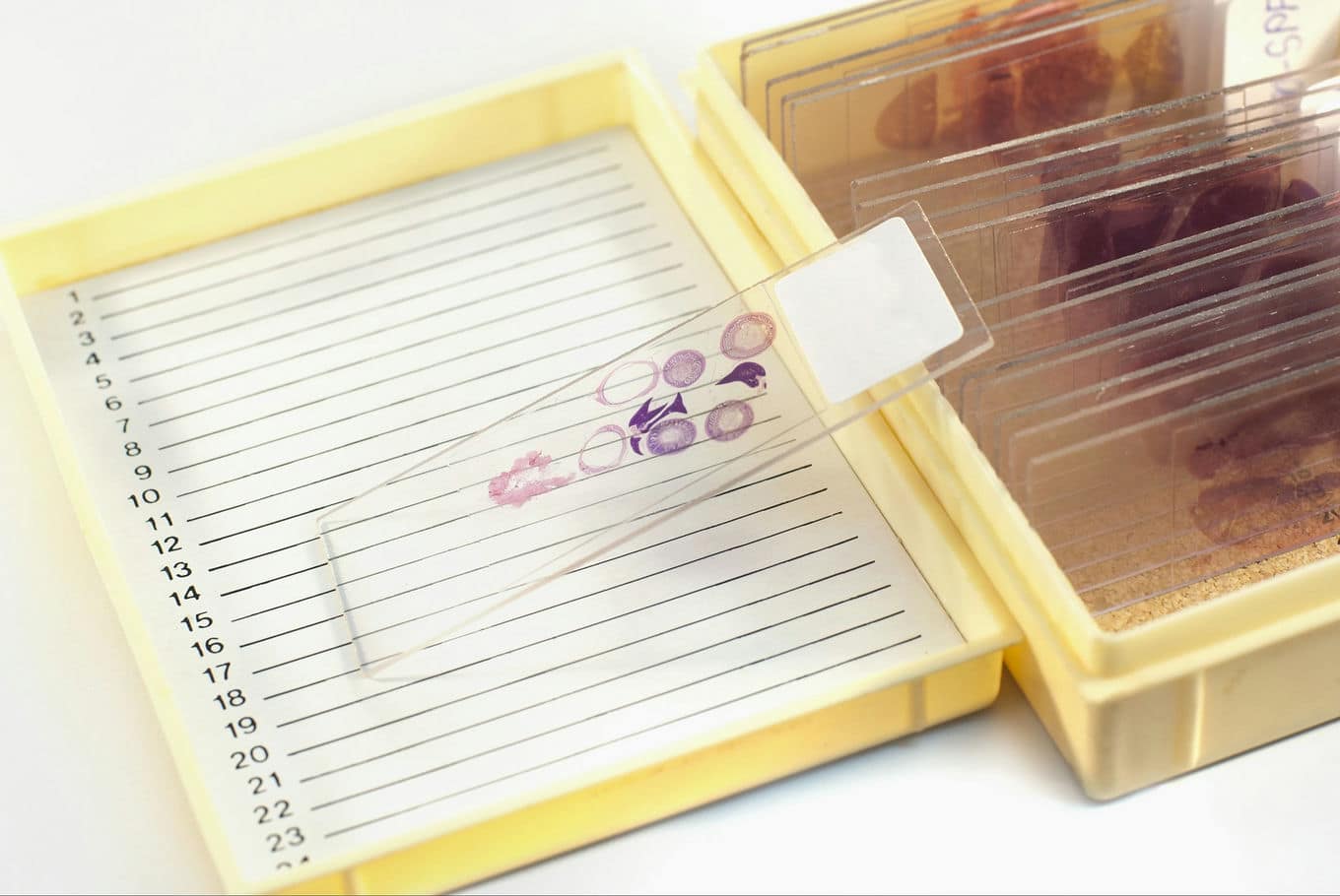 kasetka z płytkami histologicznymi