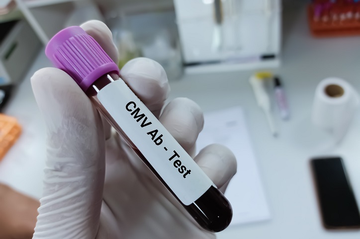 test antygenowy na wirus CMV